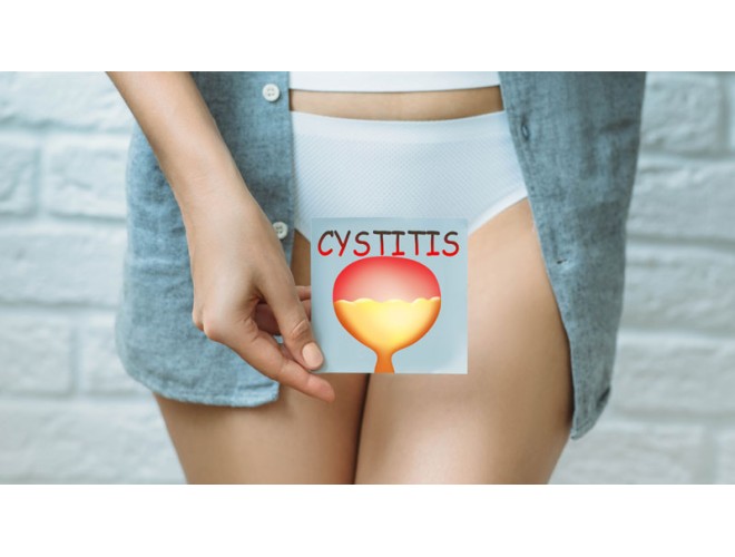 Q&A - Essential oils for cystitis Q&A - Essential oils for cystitis